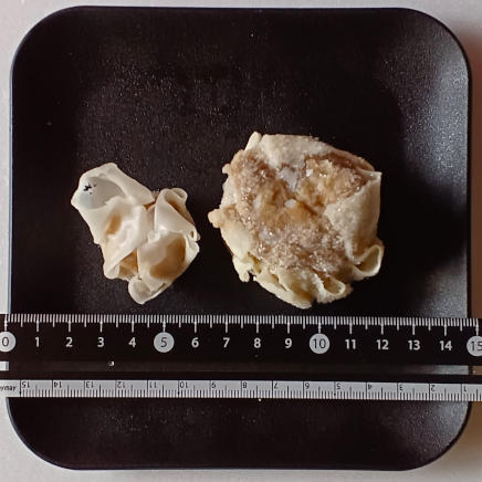 大小サイズのシュウマイ大きさ比較