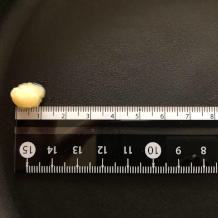 無限キャベツ 6